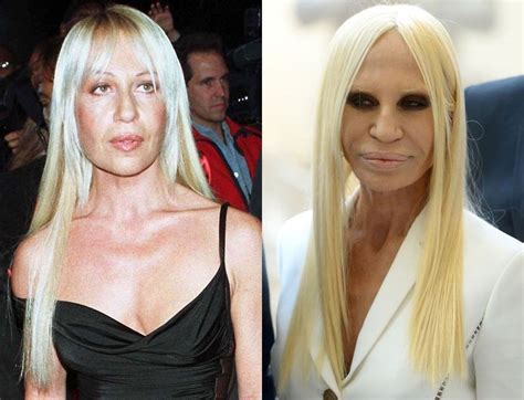 blue donatella versace|donatella versace before and after.